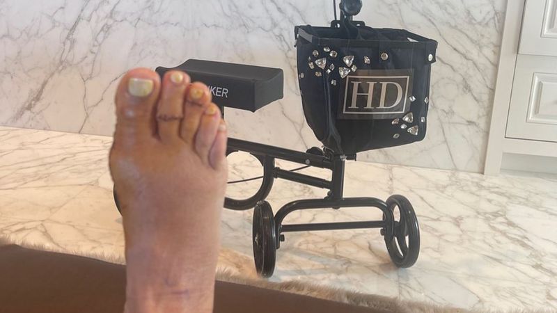 Heather Dubrow Foot Cirurgia (cirurgia de joanete)